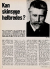 Kan skinsyge helbredes?