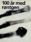 100 år med røntgen 