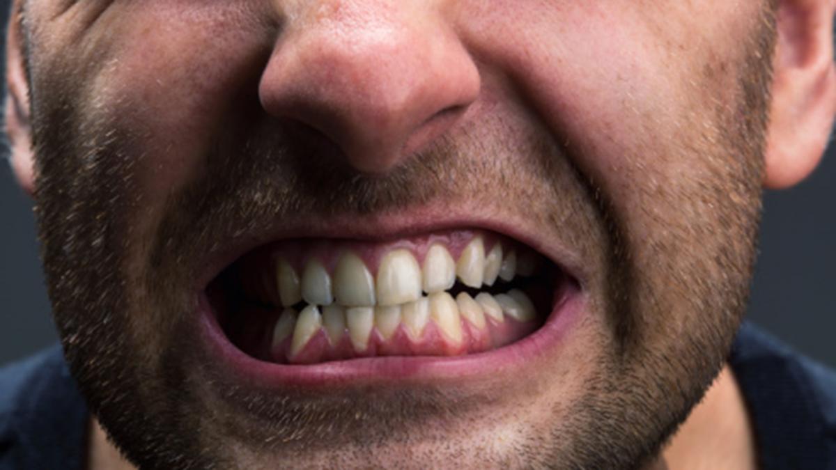 tolerance Takt rent Tygger du som en rotte eller en ko – det har stor betydning, hvis du skærer  tænder | Samvirke