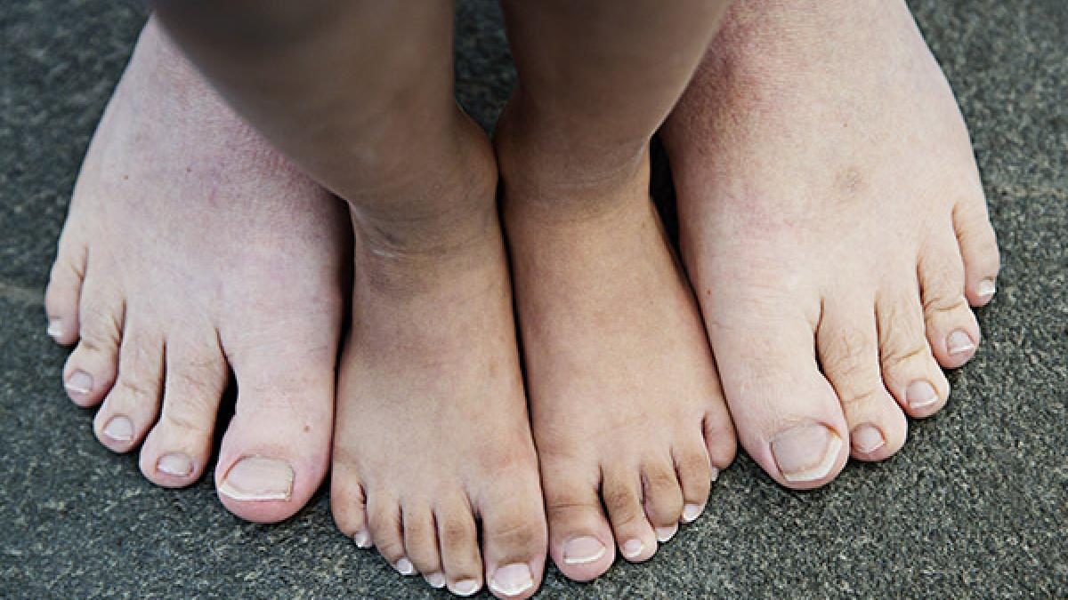 universitetsområde Motivering forudsigelse Danskernes fødder: Se, hvor forskellige 11 par fødder kan se ud | Samvirke
